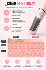 Exfoliadora Eléctrica para Pies | Velira ®